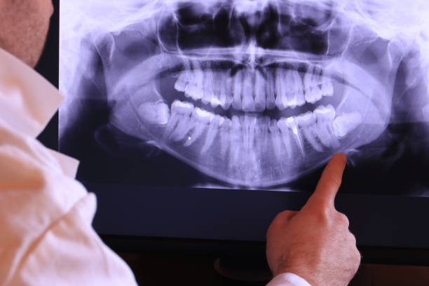Best Emergency Treatment for Jaw Pain or Injury in Spartanburg, SC